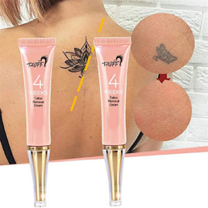 Tattoo Removal Cream by Lyplus
